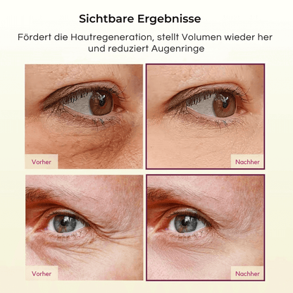 Calcium Straffungspflege | Stick & Eye Patches