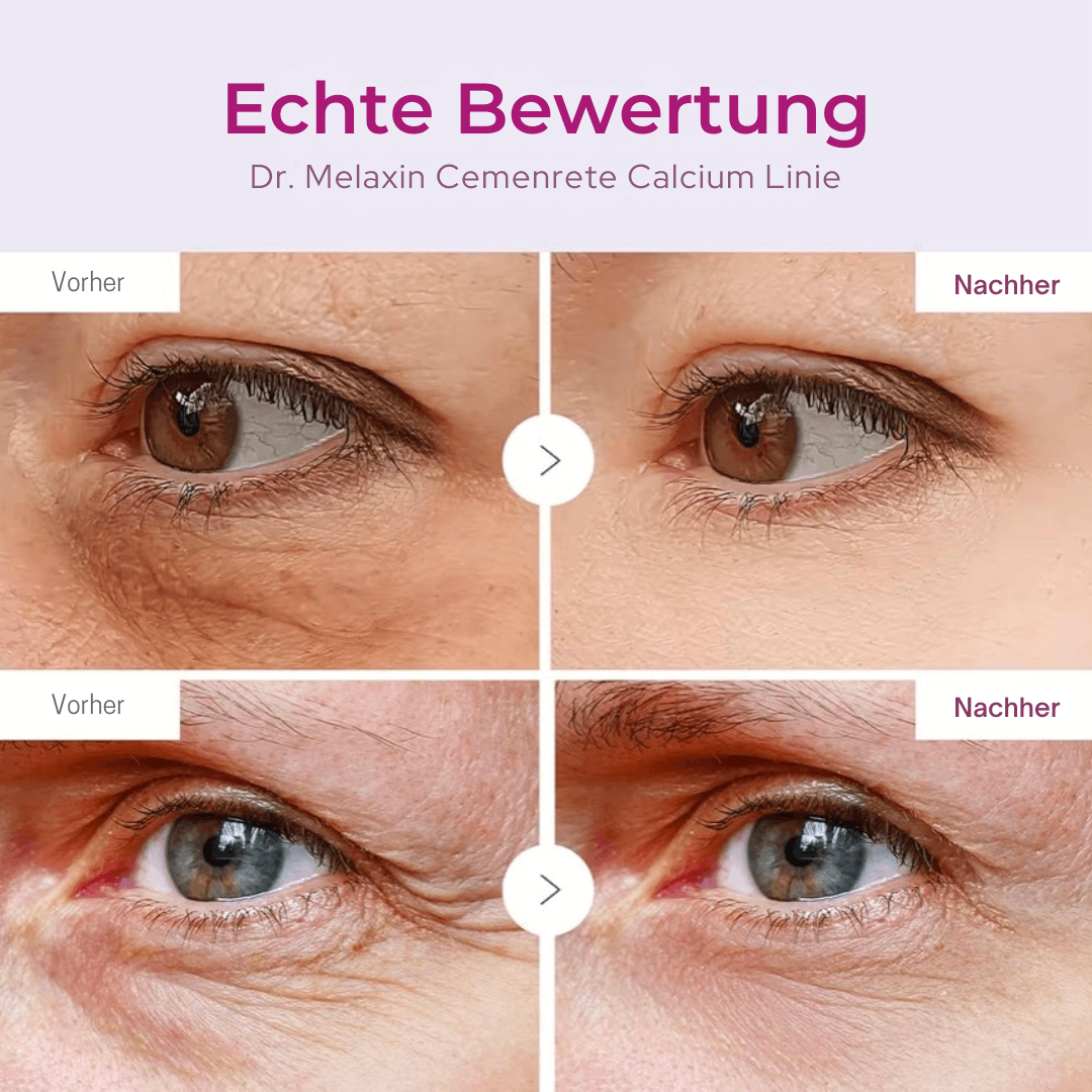 Calcium Straffungspflege | Stick & Eye Patches