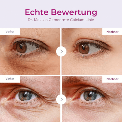 Calcium Straffungspflege | Stick & Eye Patches