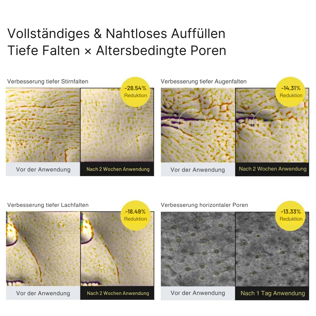 Vita-A Straffungspflege